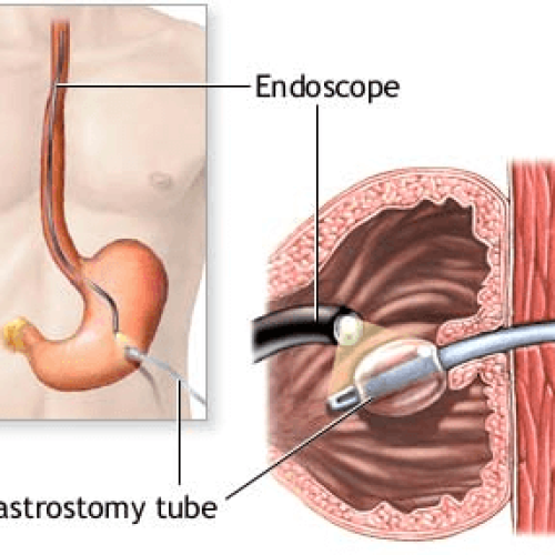 INTERVENTIONAL ENDOSCOPY 3