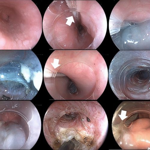 INTERVENTIONAL ENDOSCOPY 4