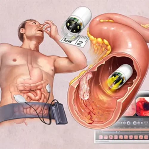 INTERVENTIONAL ENDOSCOPY 6