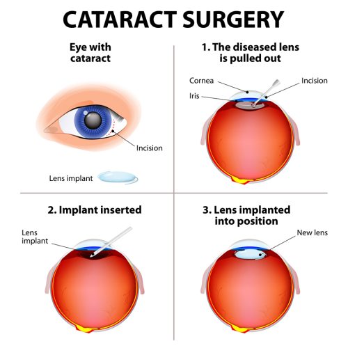 EYE CENTER VASCO