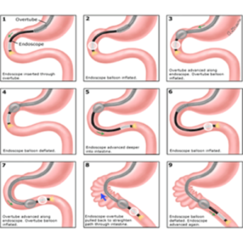 INTERVENTIONAL ENDOSCOPY 1