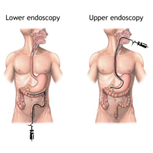 INTERVENTIONAL ENDOSCOPY 5