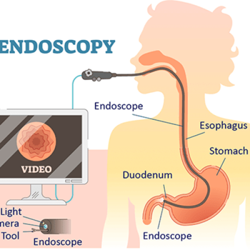 INTERVENTIONAL ENDOSCOPY 2