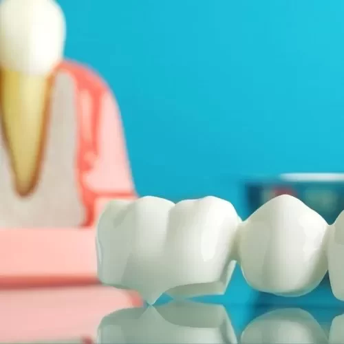 DENTAL CARE